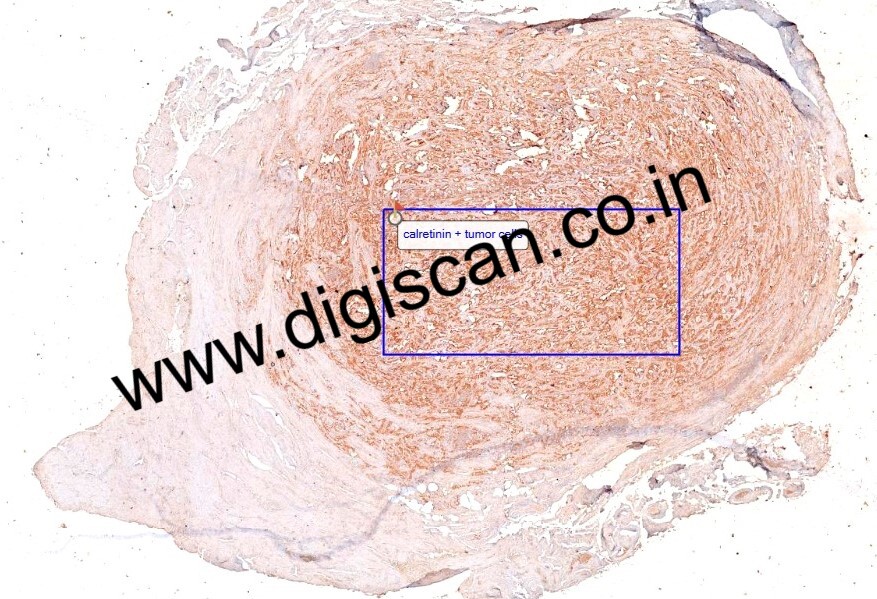 Immunohistochemistry Digital Slides Set (IHC Markers & Cases)