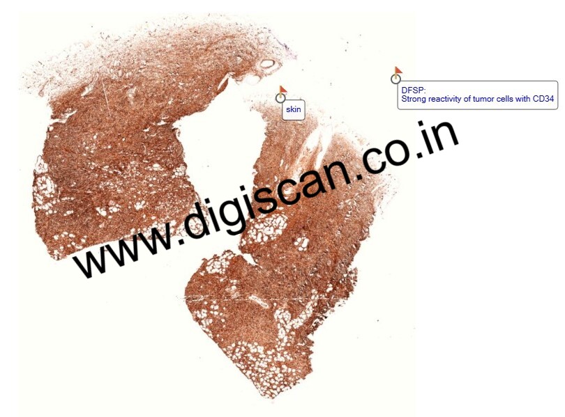Immunohistochemistry Digital Slides Set (IHC Markers & Cases)