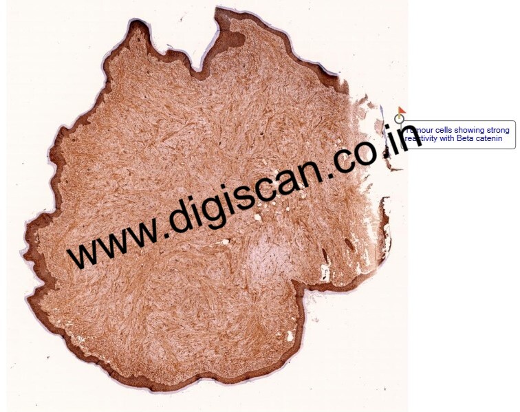 Immunohistochemistry Digital Slides Set (IHC Markers & Cases)