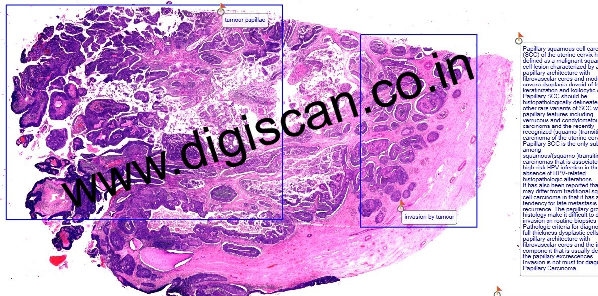 MD Pathology Exam Cases (Digital Slides & Spot Diagnosis Cases)