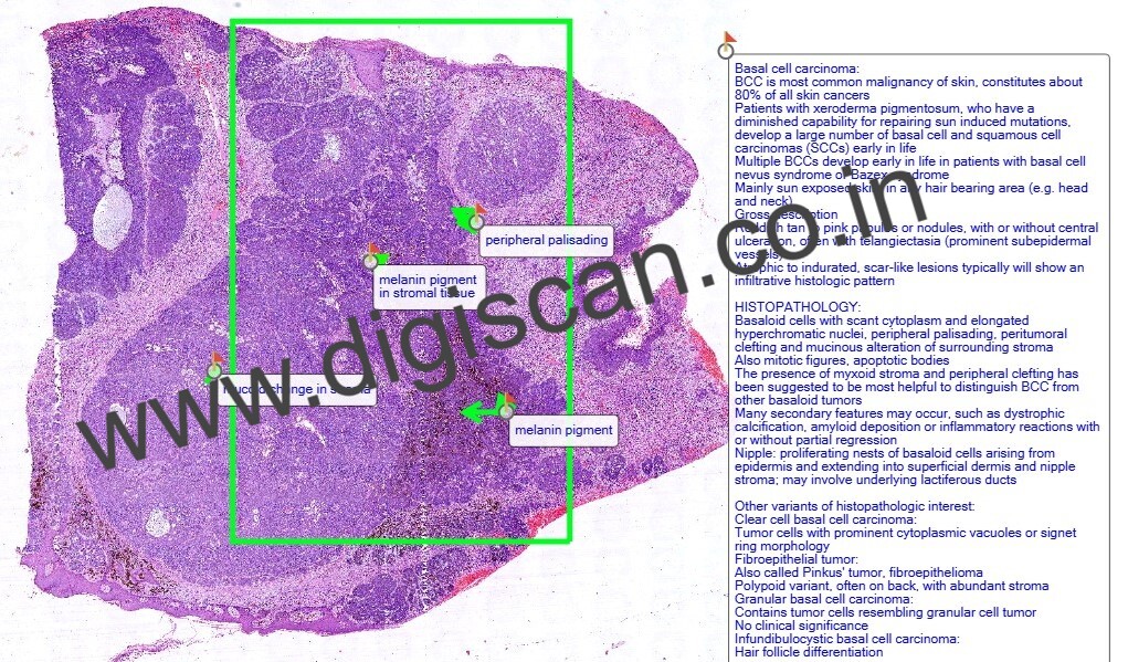 Dermatopathology Quiz Cases (Digital Slides for PG Exam & Self-Assessment)