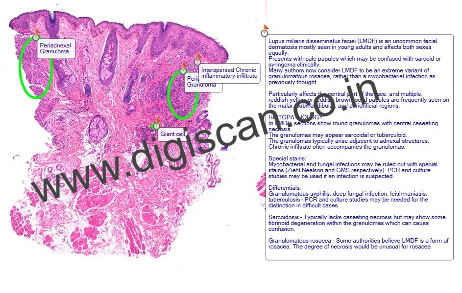 Dermatopathology Quiz Cases (Digital Slides for PG Exam & Self-Assessment)
