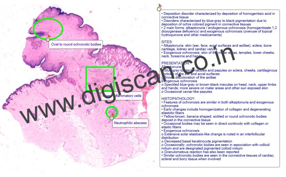 Dermatopathology Quiz Cases (Digital Slides for PG Exam & Self-Assessment)