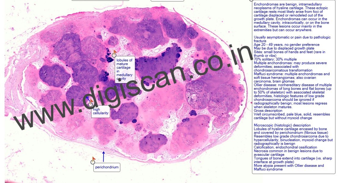 Digital Histopathology Slide Sets (With Annotated Histology Slides)