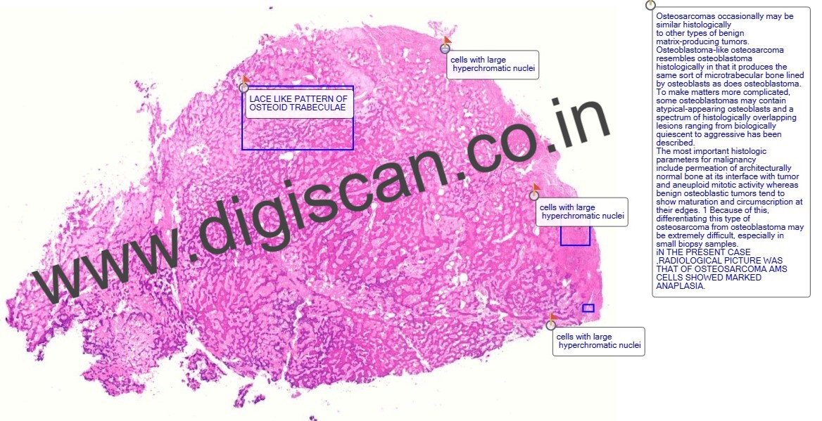 Digital Histopathology Slide Sets (With Annotated Histology Slides)