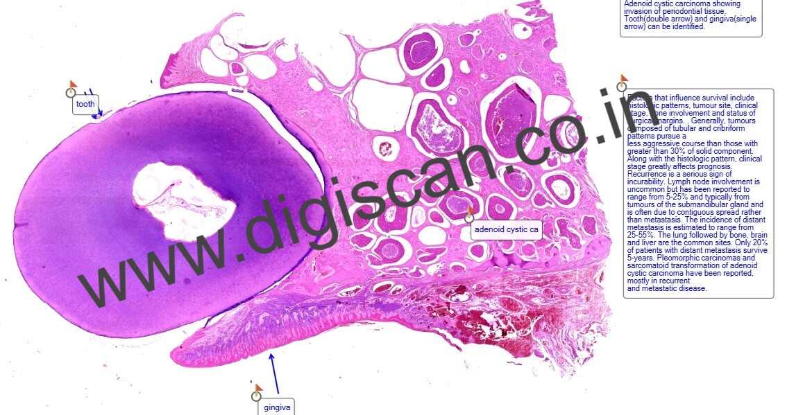 Oral Pathology Digital Slides Set (MDS & PG Students)