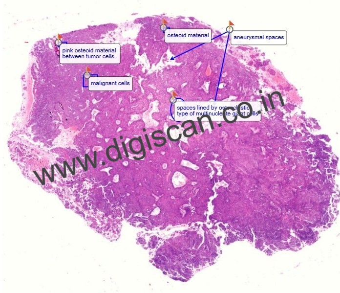 Oral Pathology Digital Slides Set (MDS & PG Students)