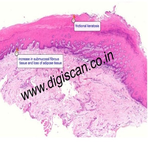 MDS Oral Pathology Exam Cases (Digital Slides & Spot Diagnosis)