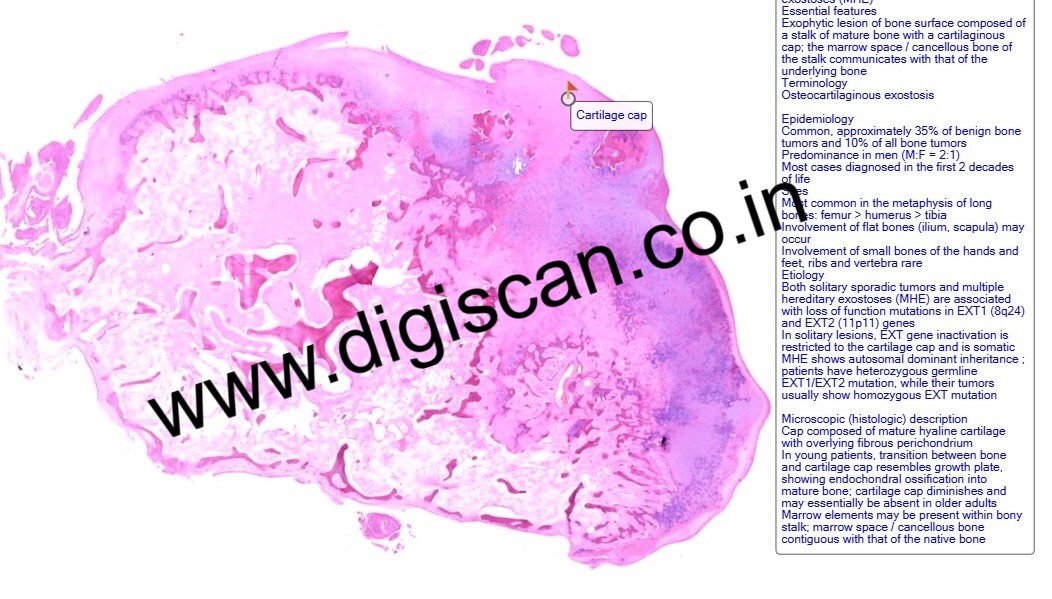 MDS Oral Pathology Exam Cases (Digital Slides & Spot Diagnosis)