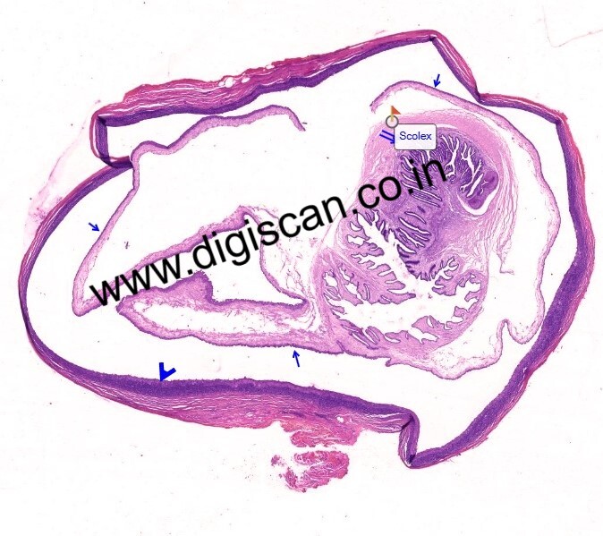 Pathology Digital Slides Set (Basic Pathology & Pathological Processes)