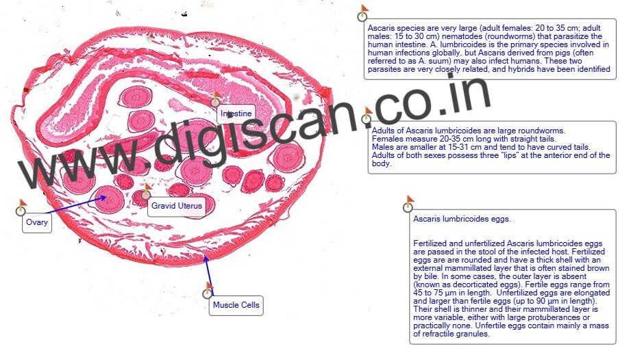 Microbiology & Parasitology Digital Slides Set (Bacteria, Fungi, Parasites & Viruses)
