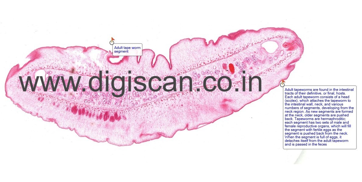 Microbiology & Parasitology Digital Slides Set (Bacteria, Fungi, Parasites & Viruses)