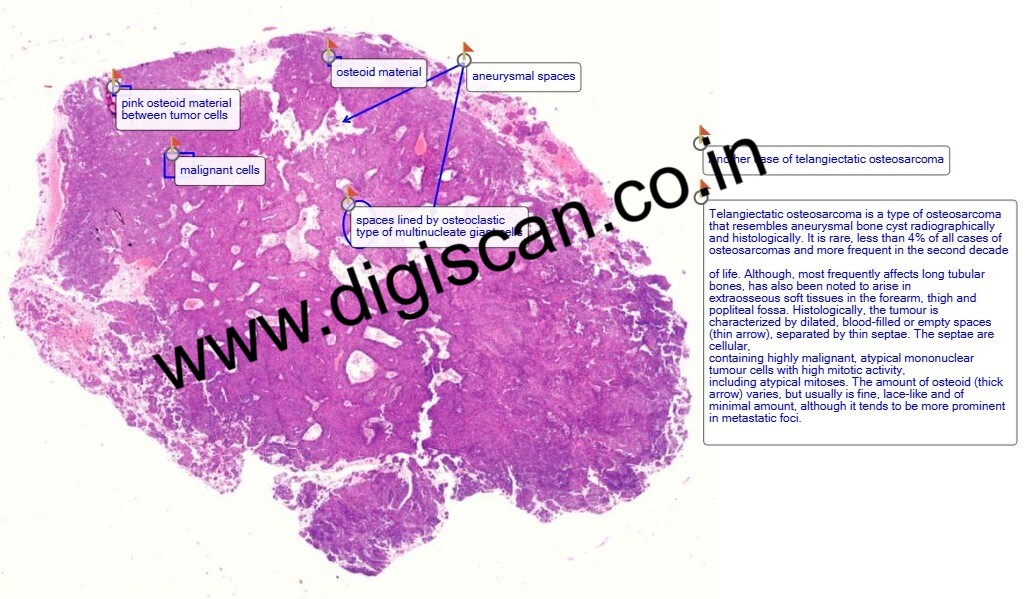 MBBS General Pathology Digital Slides Set (Microscopic Pathology)